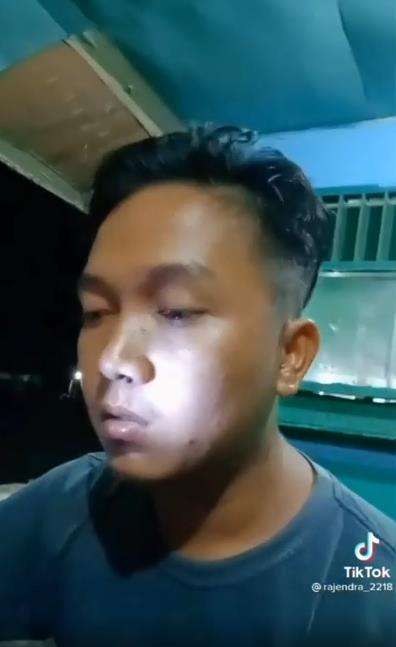 Lintah masuk hidung pemuda.