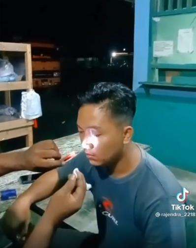 Lintah masuk hidung pemuda.
