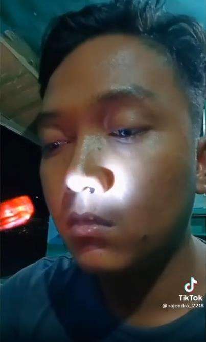 Lintah masuk hidung pemuda.