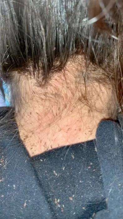 Bikin bergidik, butuh sembilan jam buat hilangkan kutu rambut.