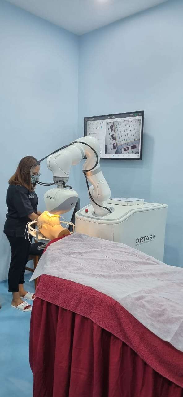 Robotic Hair Transplant