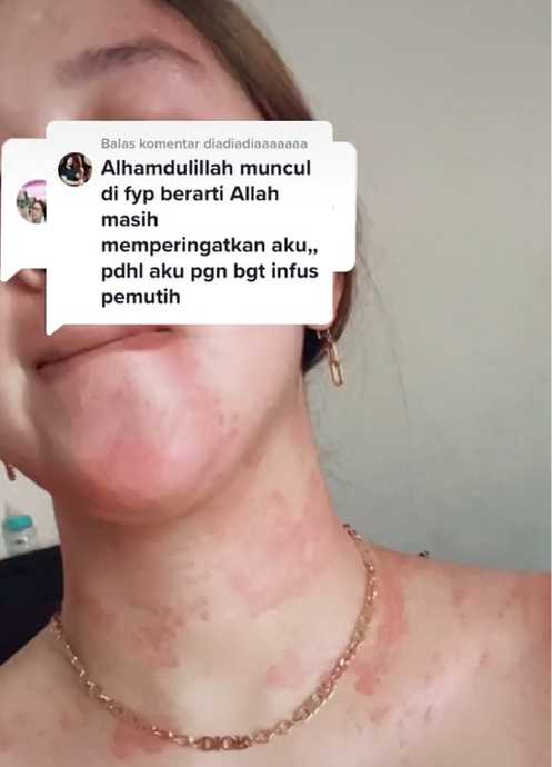 Dampak Buruk Suntik Putih