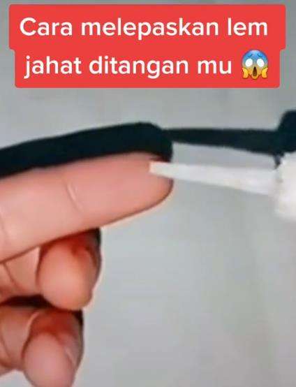 Tips lepaskan jari yang lengket kena lem besi.