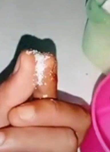 Tips lepaskan jari yang lengket kena lem besi.