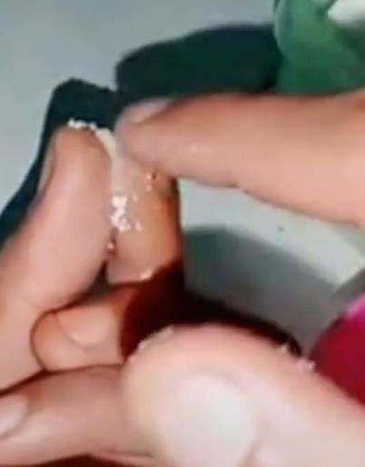 Tips lepaskan jari yang lengket kena lem besi.