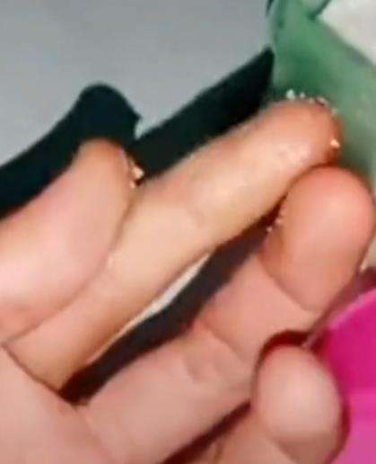 Tips lepaskan jari yang lengket kena lem besi.