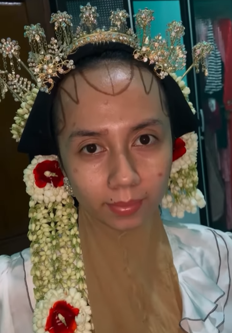 Pengantin Punya Bekas Cacar Saat Dirias