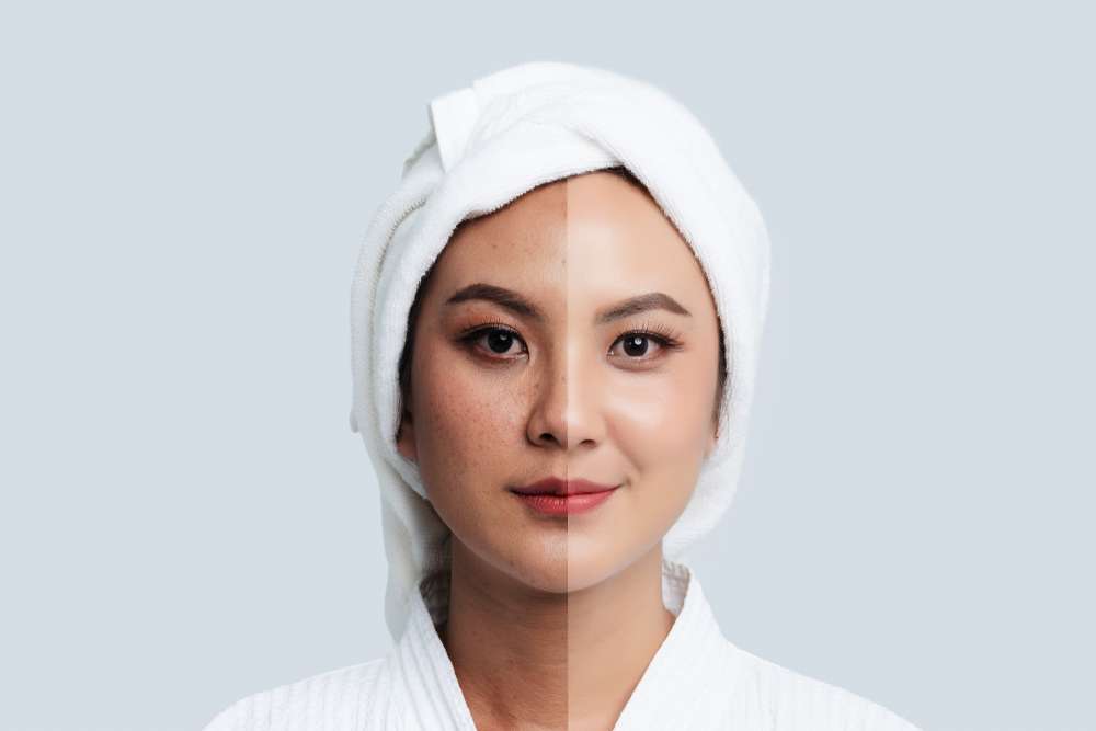 Perhatikan 4 Tanda Skincare Nggak Cocok Digunakan, Segera Stop Penggunaannya