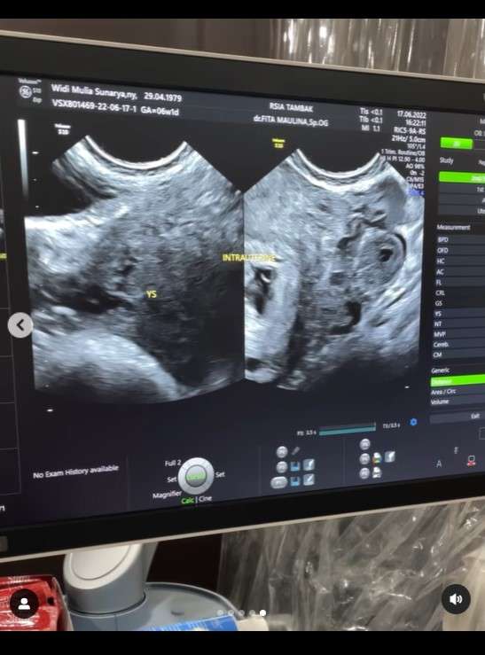 Widi B3 hamil anak keempat