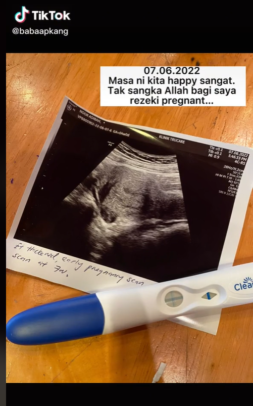 Viral Kisah Pilu Suami Meninggal Saat Istri Dinyatakan Hamil