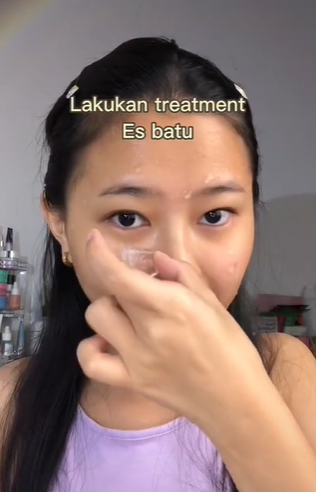 Memakai Es Batu