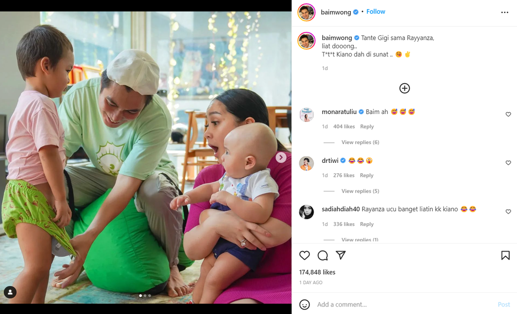 Baim Wong Menunjukkan Hasil Sunat Kiano ke Nagita
