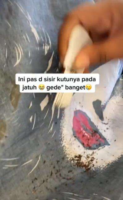 Bikin merinding, rambut penuh kutu beserta telur dan bayinya.