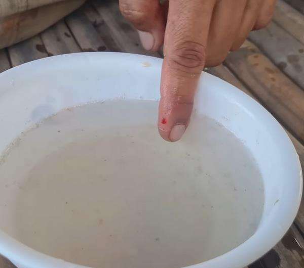 Gurunya Panji Petualang bagikan tips atasi gigitan ular kobra.