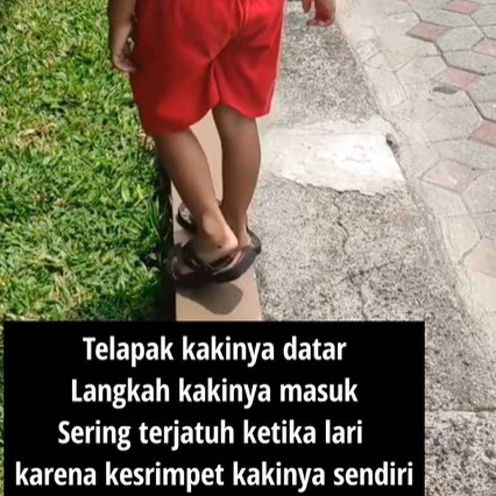 Flat foot