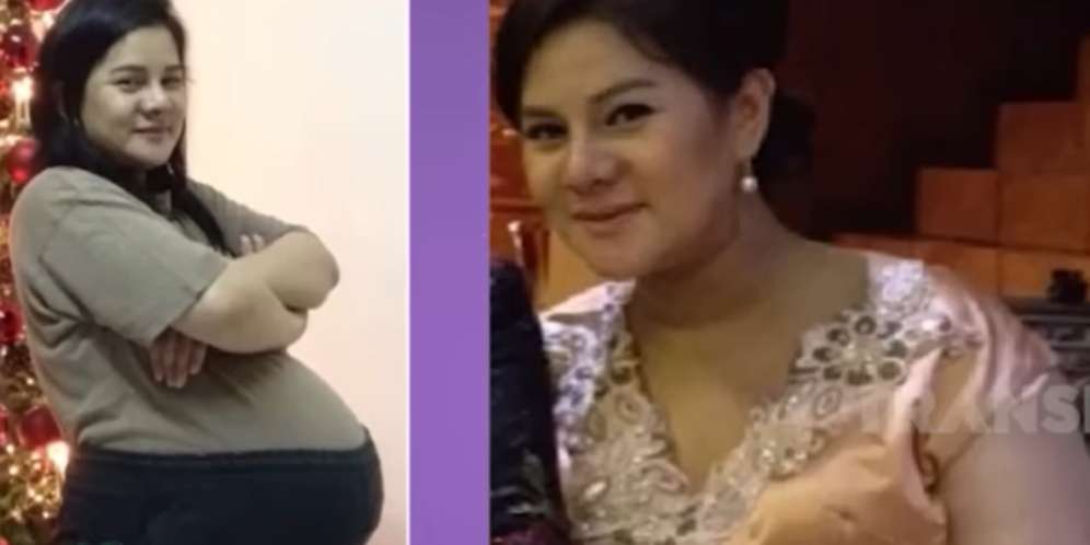Potret Astrid Tiar saat miliki berat badan hingga 104 kilogram.