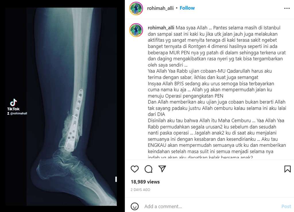Unggahan Rohimah