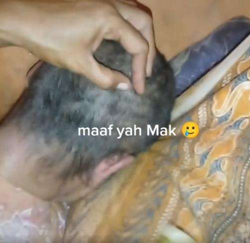 Bikin merinding, kepala nenek jadi sarang ribuan kutu rambut.