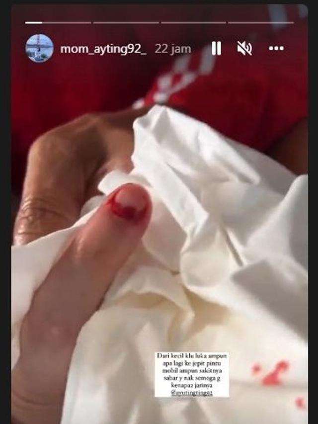 Ayu Ting Ting terluka