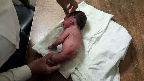 Kasihan, bayi lahir cacat tanpa kaki tapi tanduk besar.