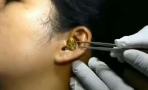 Ular masuk telinga wanita India.