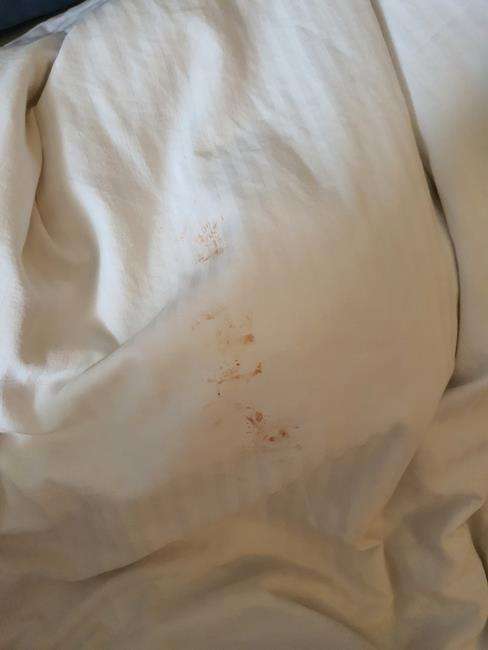 Tamu hotel kecewa, kamar sangat kotor penuh darah dan noda bekas cairan.