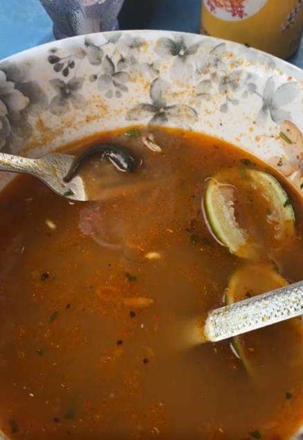 Ngeri, makan mie habis semangkuk, baru tahu ada pacet tenggelam di kuahnya.