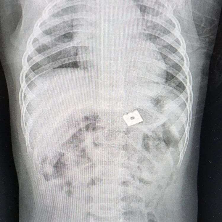 Xray