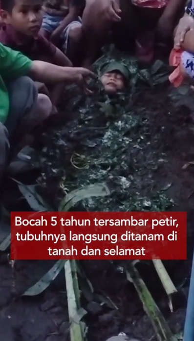 Viral Bocah Tersambar Petir di Sumut Selamat Usai 'Dikubur' dalam Tanah