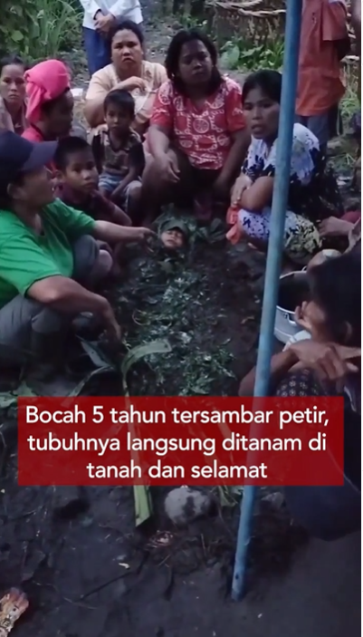 Viral Bocah Tersambar Petir di Sumut Selamat Usai 'Dikubur' dalam Tanah