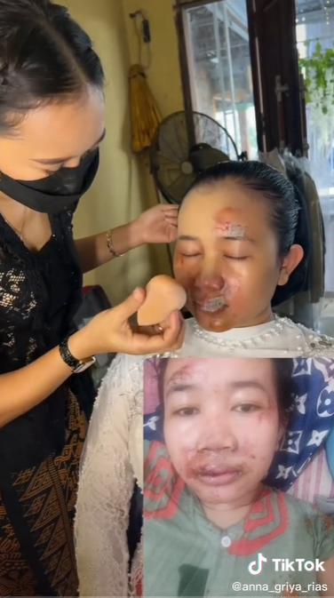MUA Rias Pengantin Setelah Kecelakaan