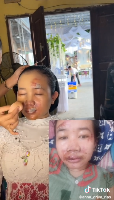 MUA Rias Pengantin Setelah Kecelakaan