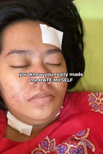 Transformasi gadis dihina perut kayak kayak karung beras.