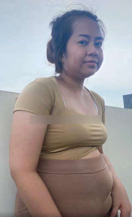 Transformasi gadis dihina perut kayak kayak karung beras.