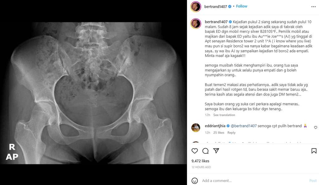 Ungahan Betrand Antolin Ungahan Betrand Antolin