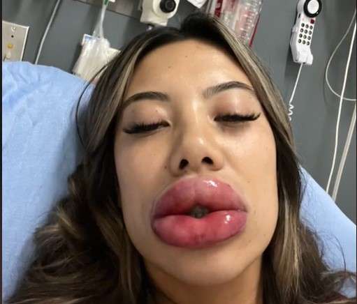 Bibir