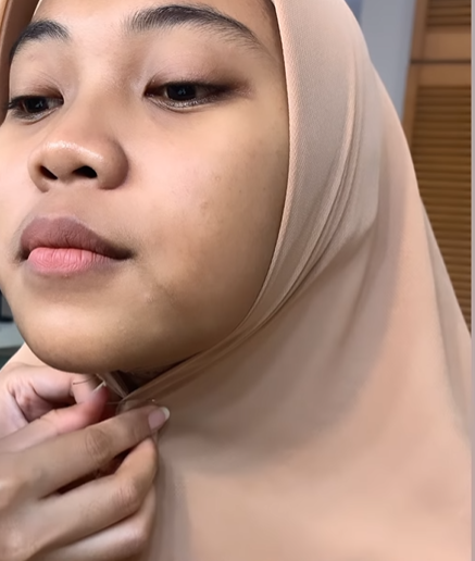 Memakai Jarum Pentol