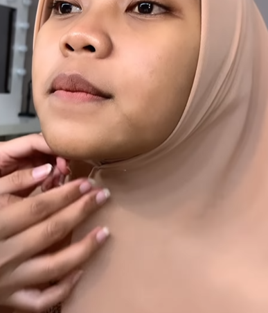 Memakai Jarum Pentol