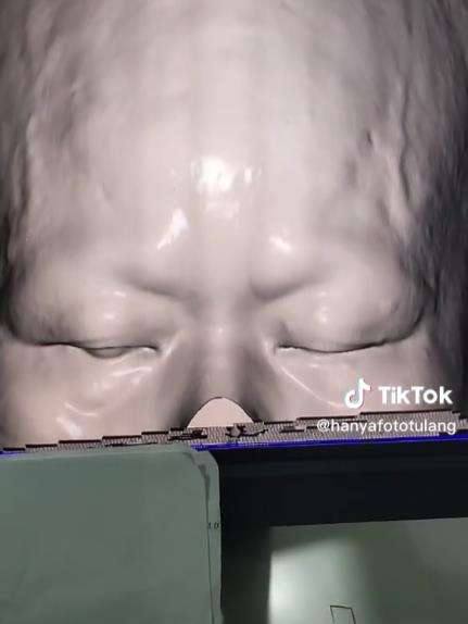 Hasil ct scan perlihatkan benda aneh di kepala pasien.