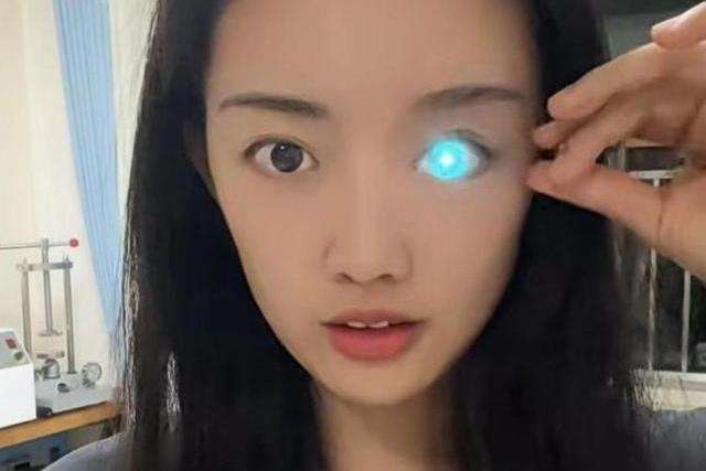 Buta karena Kecelakaan, Mata Wanita Ini Bisa Berubah Warna bak Robot