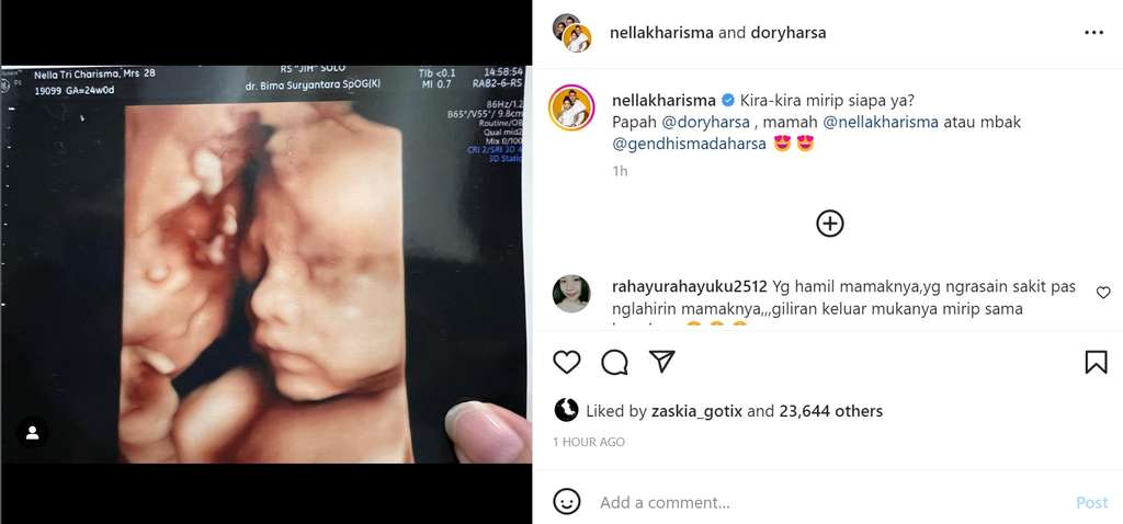 Nella Kharisma