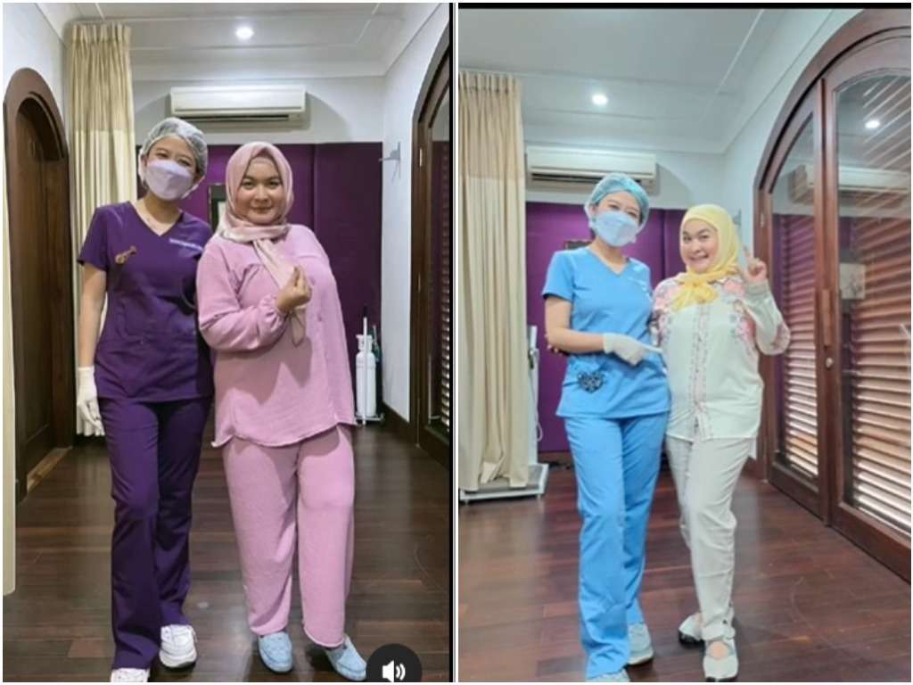 Perubahan tubuh komedian Ulfa Dwiyanthi