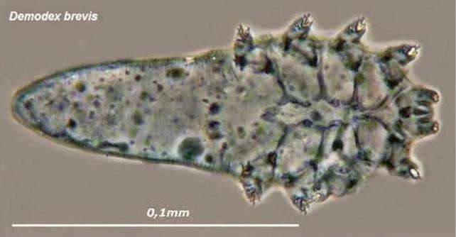 Ukuran tungau Demodex brevis.