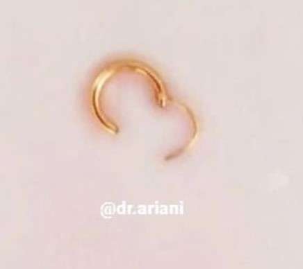 Anting