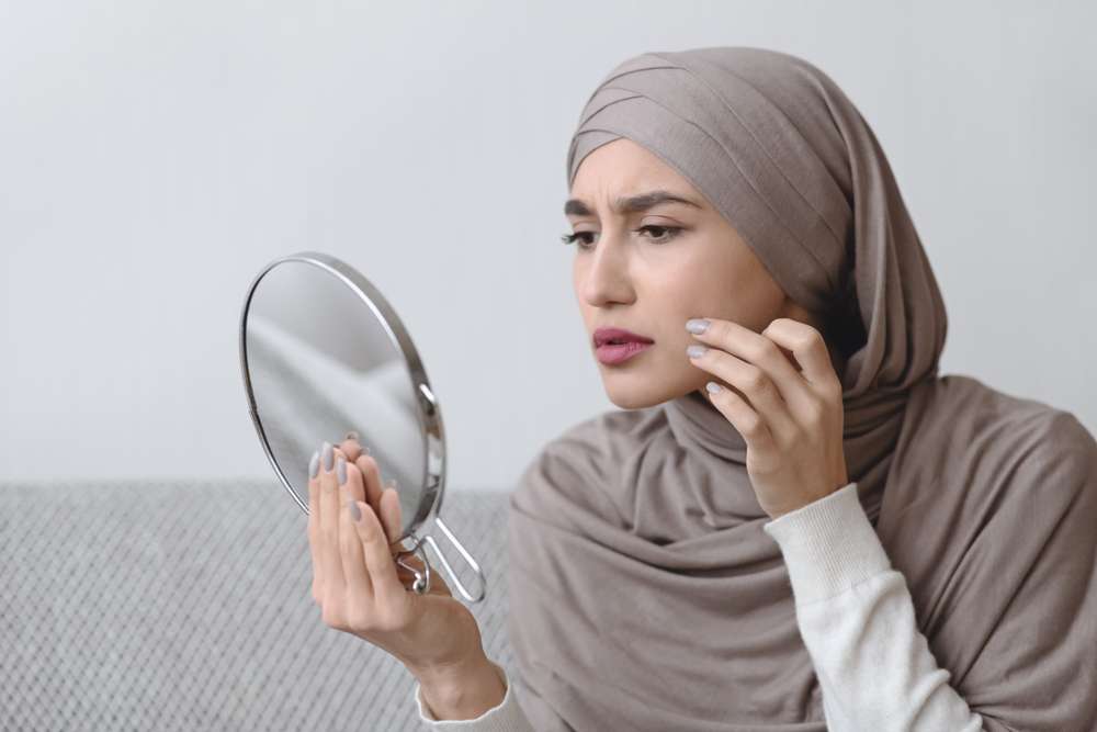 Jerawat Sering Meninggalkan Bekas? 4 Hal Ini Bisa Dilakukan untuk Pencegahan