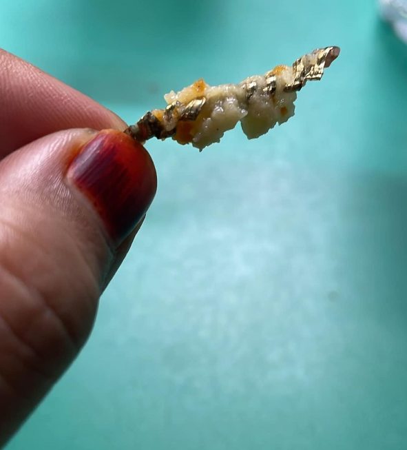 Ngeri! Wanita Ini Temukan Baut dalam Nugget: Dikira Mau Debus