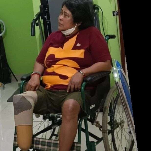 Suti Karno pakai kaki palsu Suti Karno pakai kaki palsu