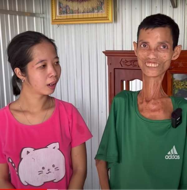 Pria Terkurus di Dunia Berbobot 20 Kg, Beruntung Istri Setia, Kini Dibuatkan Rumah