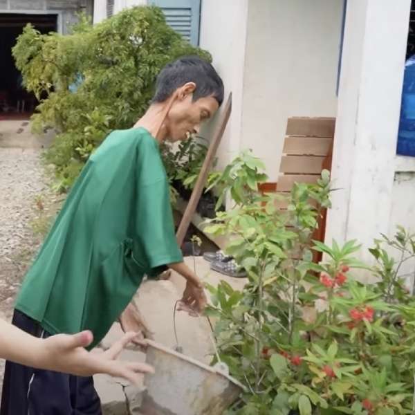 Pria Terkurus di Dunia Berbobot 20 Kg, Beruntung Istri Setia, Kini Dibuatkan Rumah