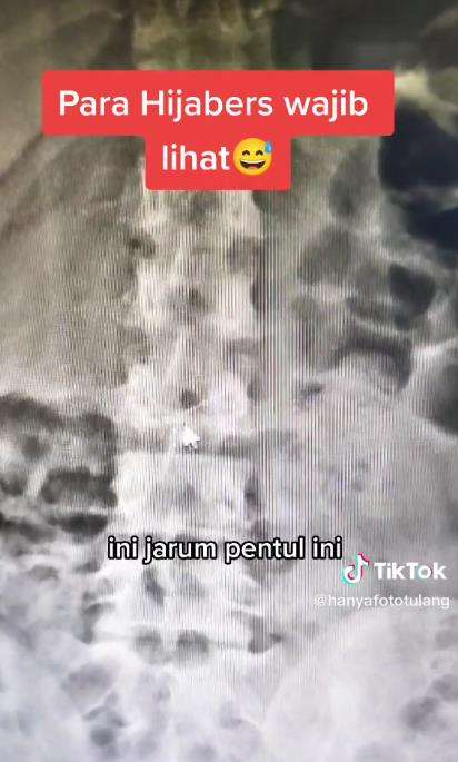 Kebiasaan buruk jepit jarum pentul pakai mulut.